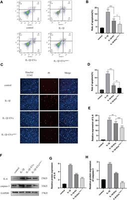 LncRNA Malat-1 From MSCs-Derived Extracellular Vesicles Suppresses Inflammation and Cartilage Degradation in Osteoarthritis